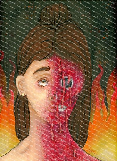 Picture of Burning Beauty